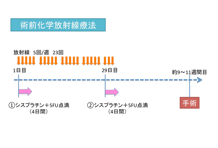 術前化学放射線療法