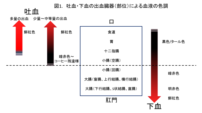 図1.吐血・下血の出血臓器（部位）による血液の色調