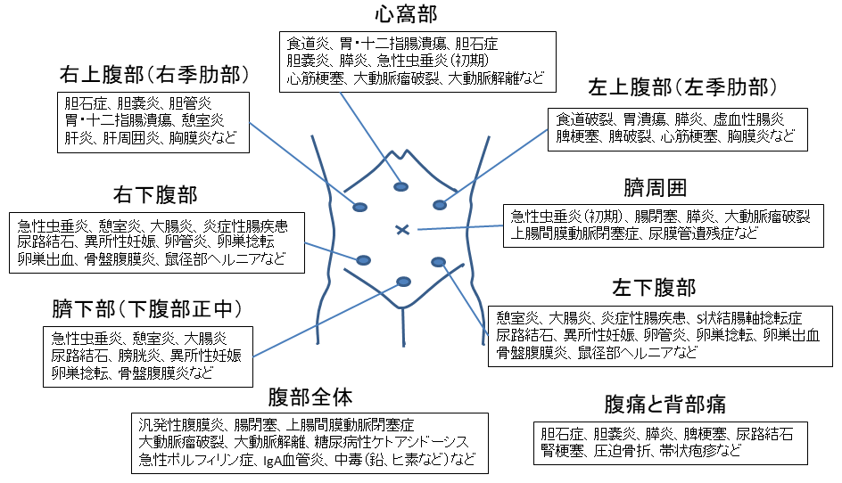 腹痛の部位と主な病気