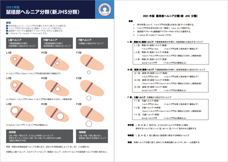 鼠径部ヘルニアの分類