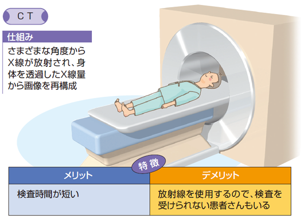 CT検査