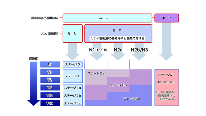 ステージ