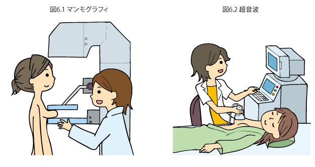 図6.1マンモグラフィ　図6.2超音波